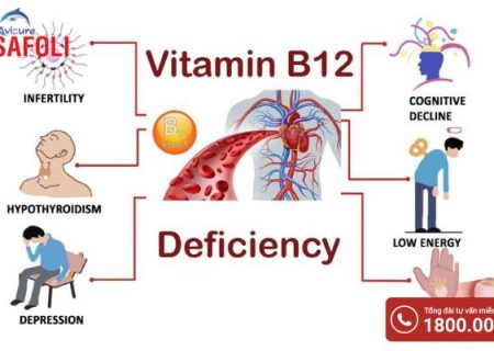 Thuốc vitamin B12 tiêm khi nào được sử dụng? Avisure Safoli