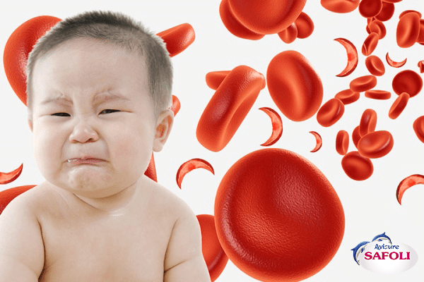 Nguyên nhân thiếu máu ở trẻ sơ sinh là gì? 