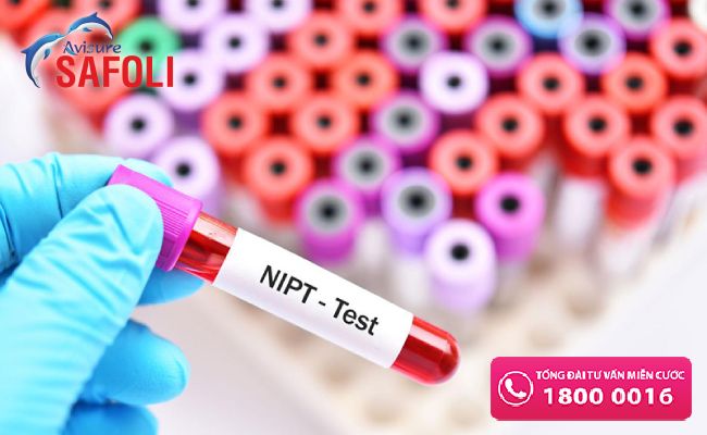 Xét nghiệm NIPT phát hiện dị tật thai nhi