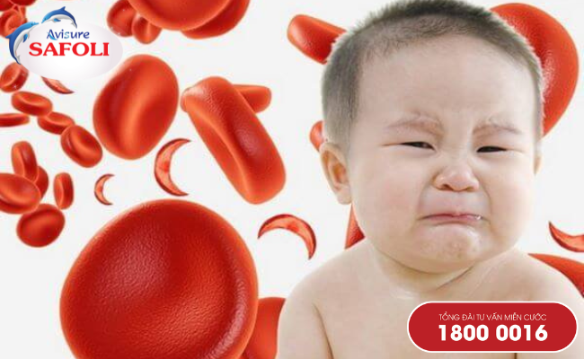 Thiếu máu hồng cầu nhỏ ở trẻ em là bệnh gì
